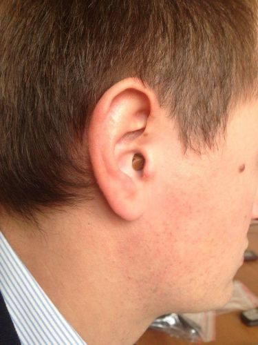 Комплект Bluetooth NOKIA PREMIUM + микронаушник « Agger» фото 3